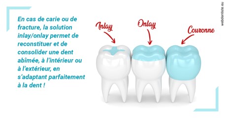 https://dr-bruno-lasfargue.chirurgiens-dentistes.fr/L'INLAY ou l'ONLAY
