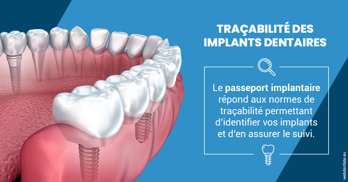 https://dr-bruno-lasfargue.chirurgiens-dentistes.fr/T2 2023 - Traçabilité des implants 1