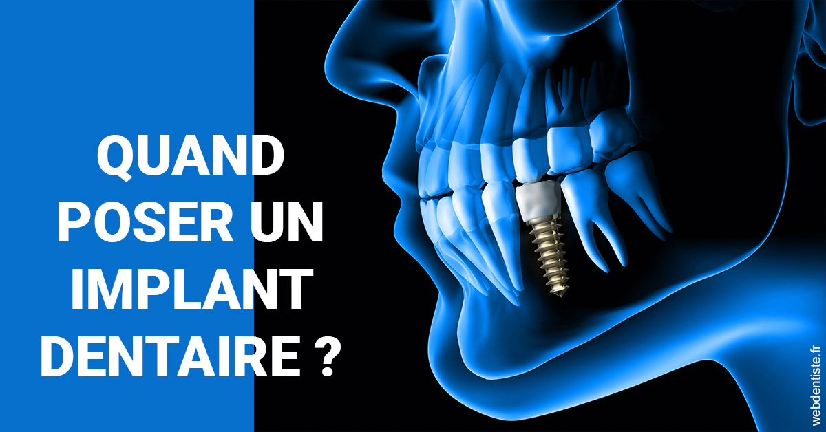 https://dr-bruno-lasfargue.chirurgiens-dentistes.fr/Les implants 1