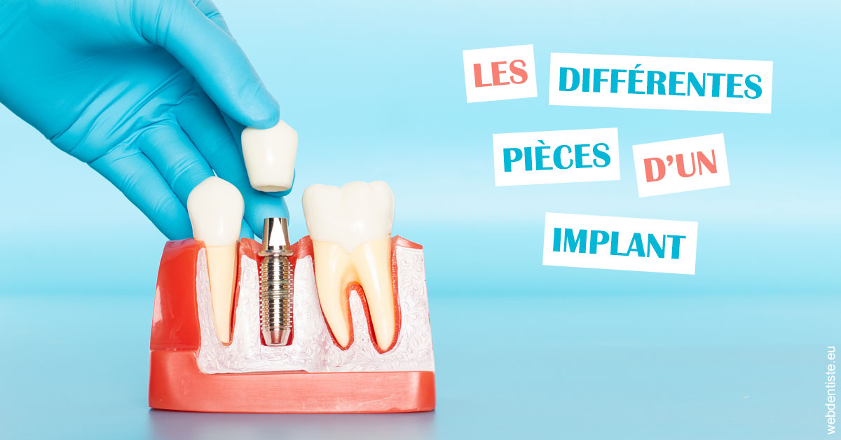 https://dr-bruno-lasfargue.chirurgiens-dentistes.fr/Les différentes pièces d’un implant 2