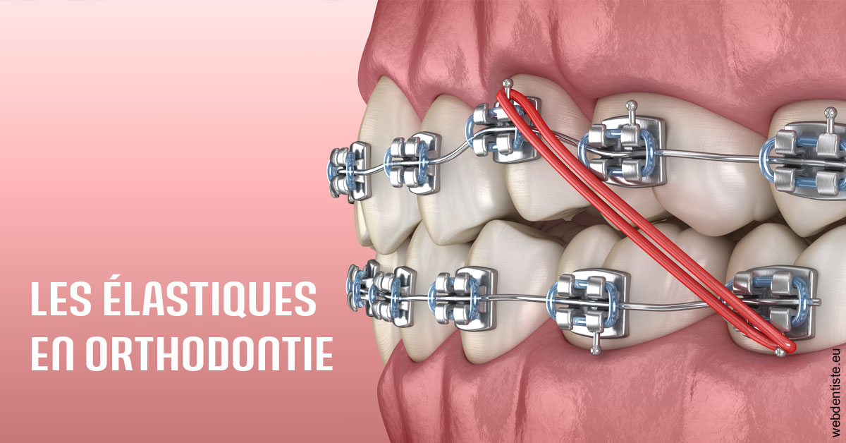 https://dr-bruno-lasfargue.chirurgiens-dentistes.fr/Elastiques orthodontie 2