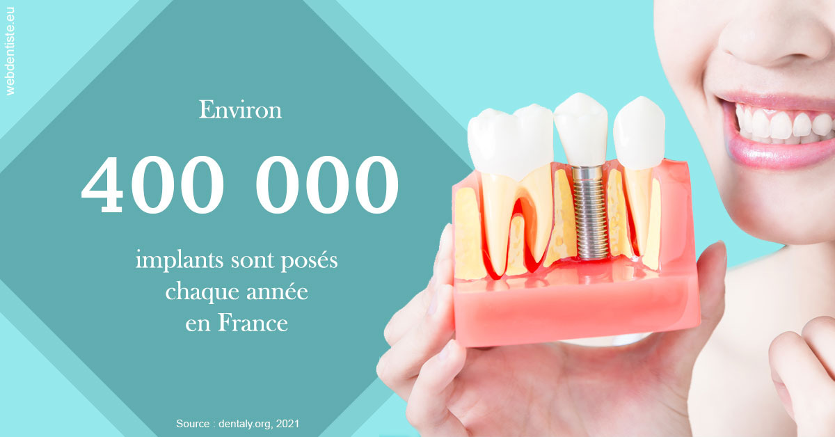 https://dr-bruno-lasfargue.chirurgiens-dentistes.fr/Pose d'implants en France 2